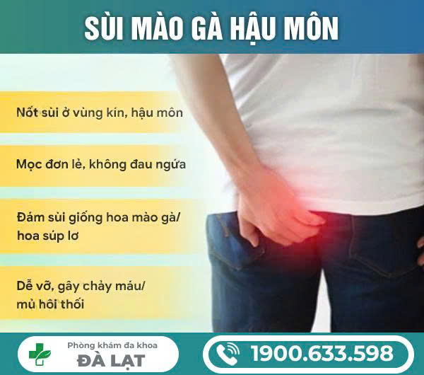 Hình ảnh minh họa